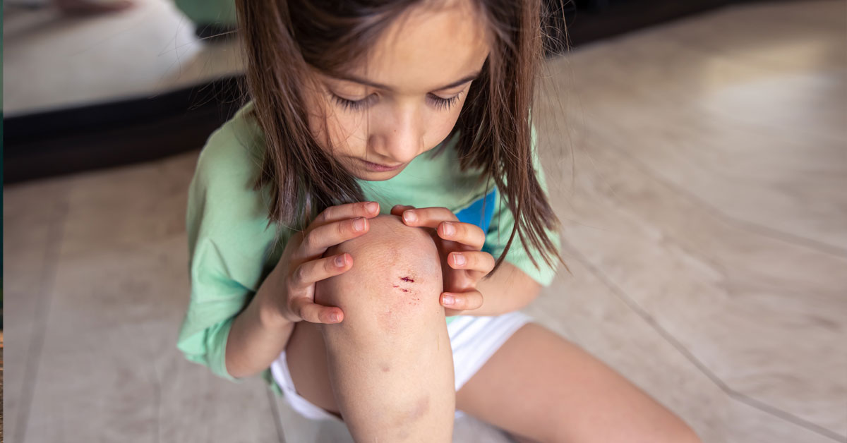 Young girl looking at bruises and scratches on her knee - recognizing signs of bullying | Taekwondo school in Peachtree City
